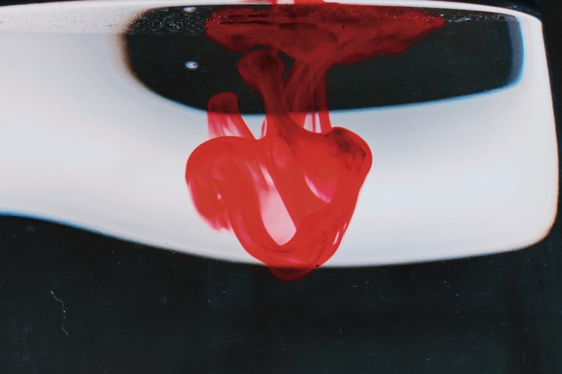 V nesreči z nevarno snovjo v hotelu v Kranjski gori tudi poškodovani