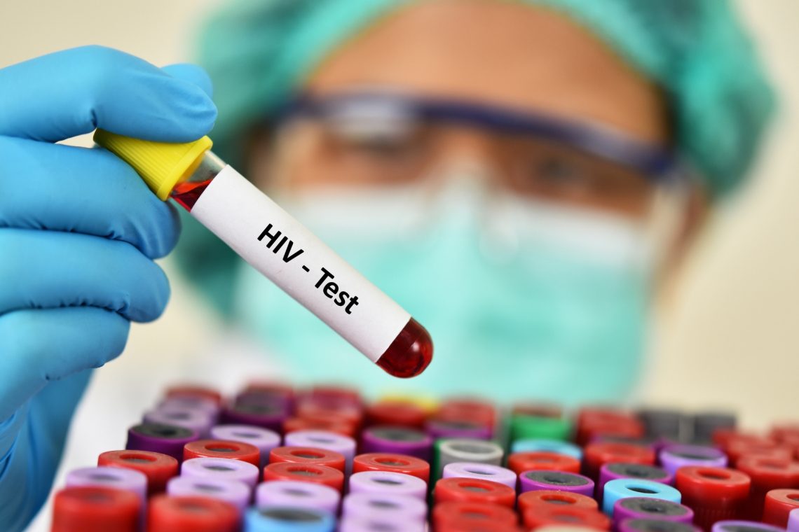 HIV okužbe se povečujejo v Evropi. Kako ukrepati?