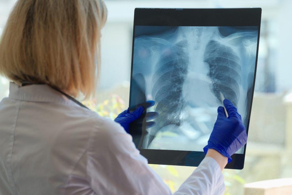 Svetovni dan KOPB v znamenju spirometrije