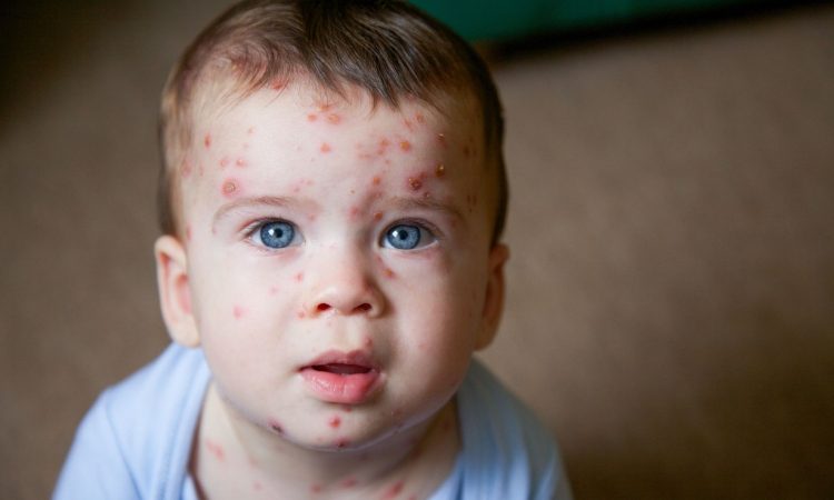 Če lahko svojega otroka zaščitimo pred bolečino in trpljenjem, zakaj bi tvegali?