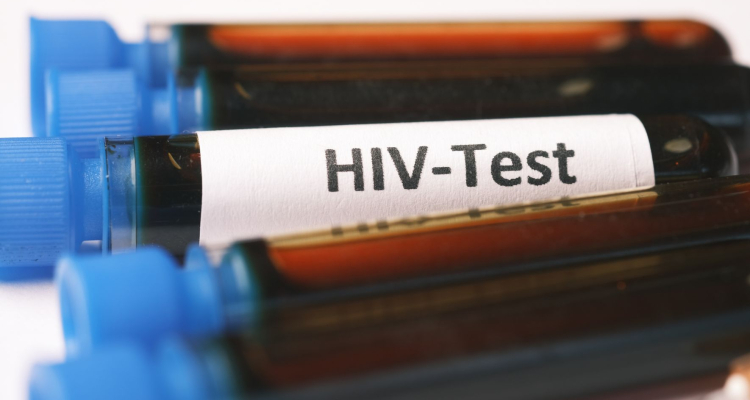 Slovenija ohranja nizko stopnjo epidemije HIV, skrb vzbujajo pozne diagnoze